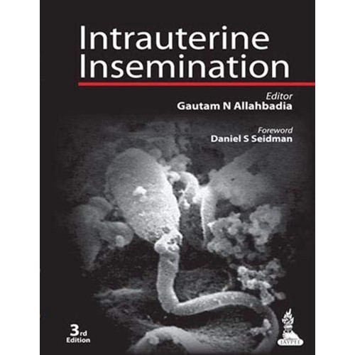 INTRAUTERINE INSEMINATION