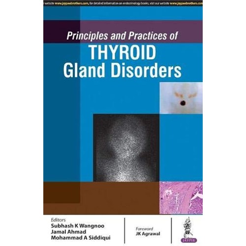 PRINCIPLES AND PRACTICES OF THYROID GLAND DIS...