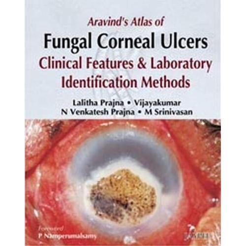 ARAVIND'S ATLAS OF FUNGAL CORNEAL ULCERS CLIN...