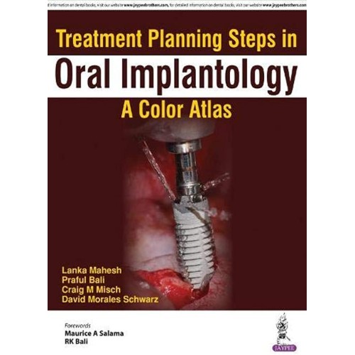 TREATMENT PLANNING STEPS IN ORAL IMPLANTOLOGY...