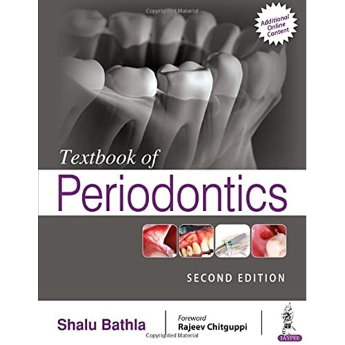 TEXTBOOK OF PERIODONTICS