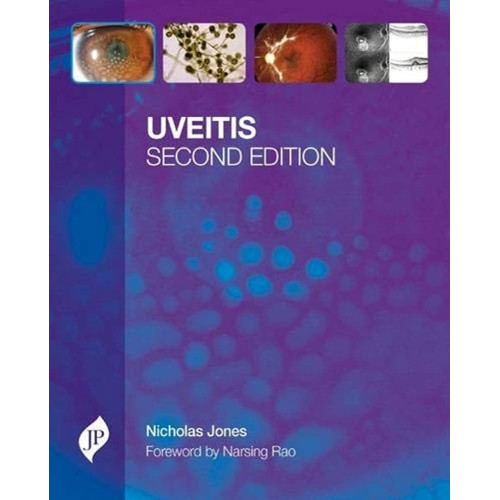 UVEITIS WITH CD-ROM