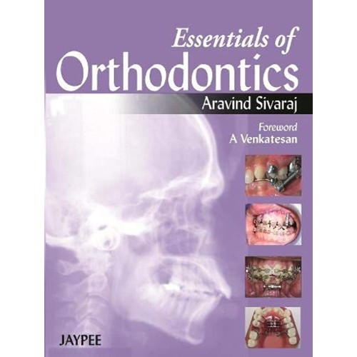 ESSENTIALS OF ORTHODONTICS