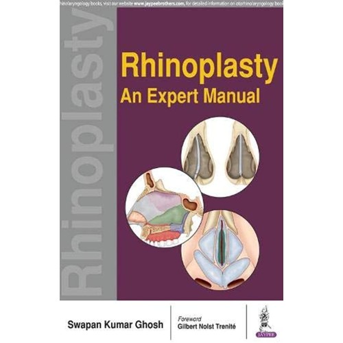 RHINOPLASTY AN EXPERT MANUAL