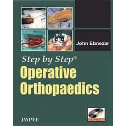 STEP BY STEP OPERATIVE ORTHOPAEDICS WITH PHOT...