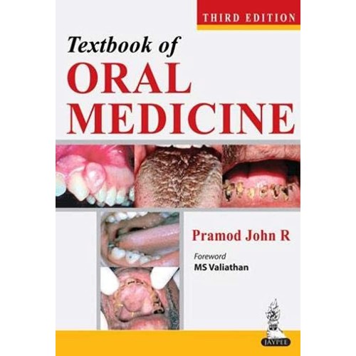 TEXTBOOK OF ORAL MEDICINE