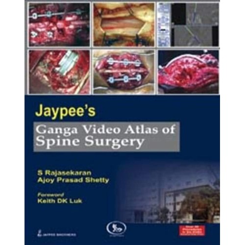 JAYPEE'S GANGA VIDEO ATLAS OF SPINE SURGERY O...