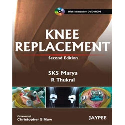 KNEE REPLACEMENT WITH INTERACTIVE DVD-ROM