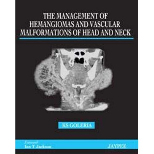 THE MANAGEMENT OF HEMANGIOMAS AND VASCULAR MA...