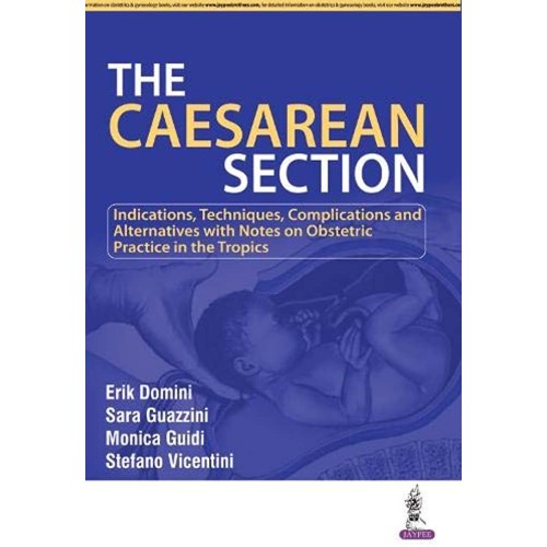 THE CAESAREAN SECITON