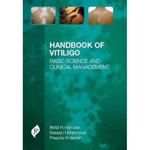 HANDBOOK OF VITILIGO BASIC SCIENCE AND CLINICAL MANAGEMENT