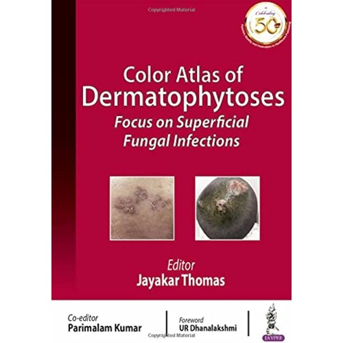 COLOR ATLAS OF DERMATOPHYTOSES: FOCUS ON SUPERFICIAL FUNGAL INFECTIONS