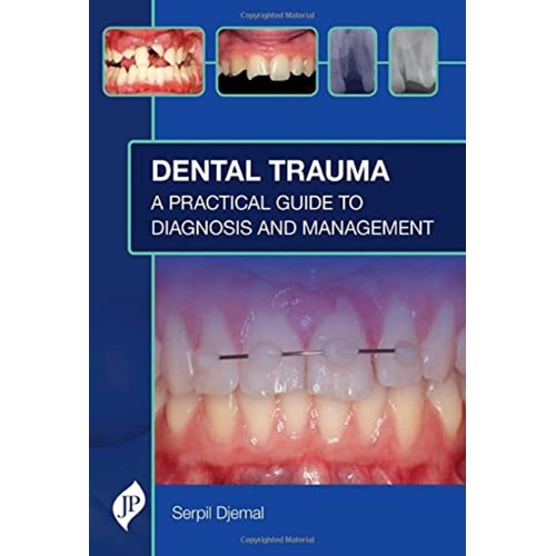 DENTAL TRAUMA: A PRACTICAL GUIDE TO DIAGNOSIS AND MANAGEMENT