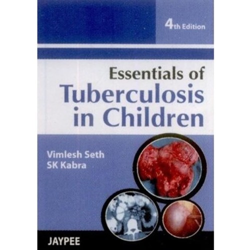 ESSENTIALS OF TUBERCULOSIS IN CHILDREN