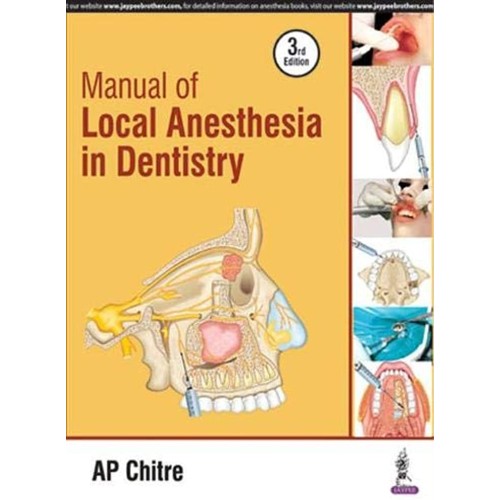 MANUAL OF LOCAL ANESTHESIA IN DENTISTRY