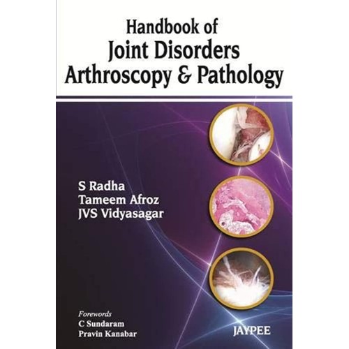 HANDBOOK OF JOINT DISORDERS ARTHROSCOPY & PATHOLOGY