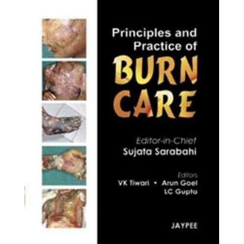 PRINCIPLES AND PRACTICE OF BURN CARE