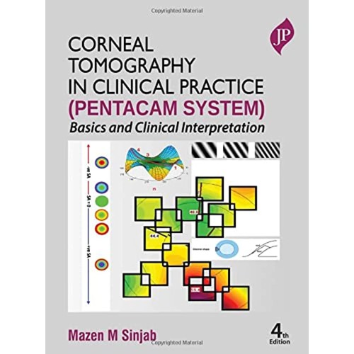 CORNEAL TOMOGRAPHY IN CLINICAL PRACTICE (PENT...