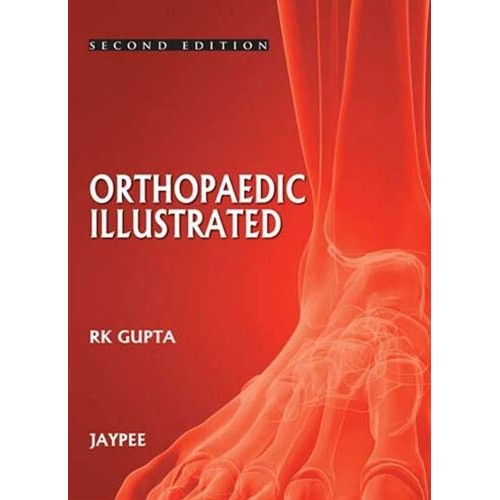 ORTHOPEDICS ILLUSTRATED