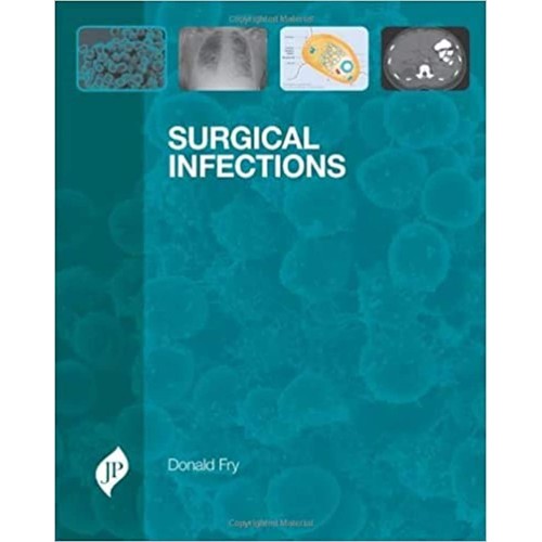 SURGICAL INFECTIONS