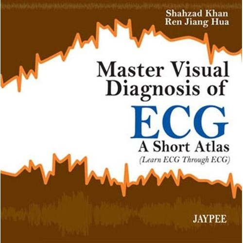 MASTER VISUAL DIAGNOSIS OF ECG A SHORT ATLAS (LEARN ECG THROUGH ECG)