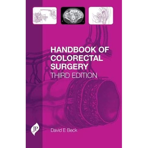 HANDBOOK OF COLORECTAL SURGERY