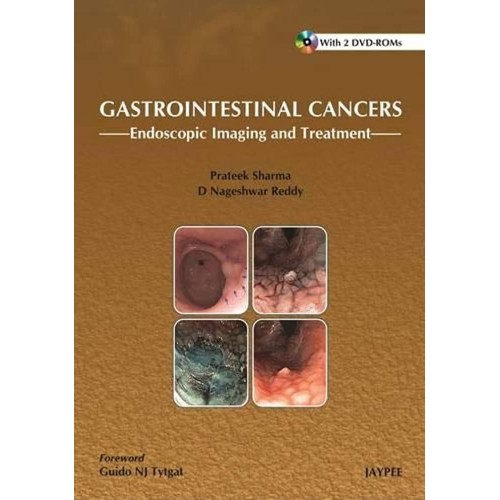 GASTROINTESTINAL CANCERS ENDOSCOPIC IMAGING AND TREATMENT WITH 2 DVD-ROMS