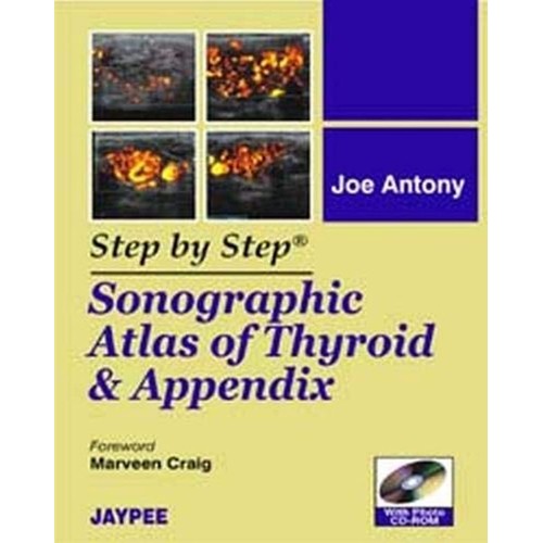 STEP BY STEP SONOGRAPHIC ATLAS OF THYROID & A...