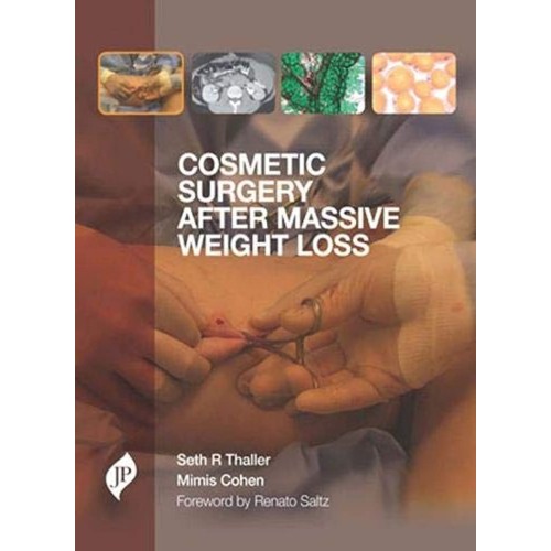 COSMETIC SURGERY AFTER MASSIVE WEIGHT LOSS