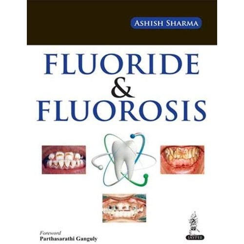 FLUORIDE & FLUOROSIS