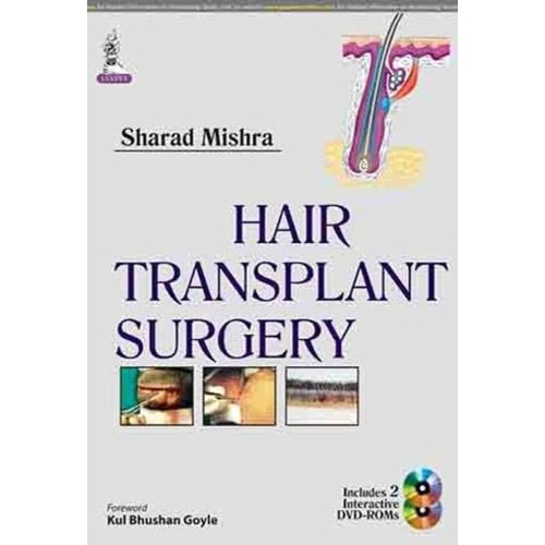 HAIR TRANSPLANT SURGERY