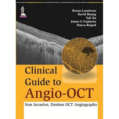 CLINICAL GUIDE TO ANGIO-OCT: NON INVASIVE,DYELESS OCT ANGIOGRAPHY