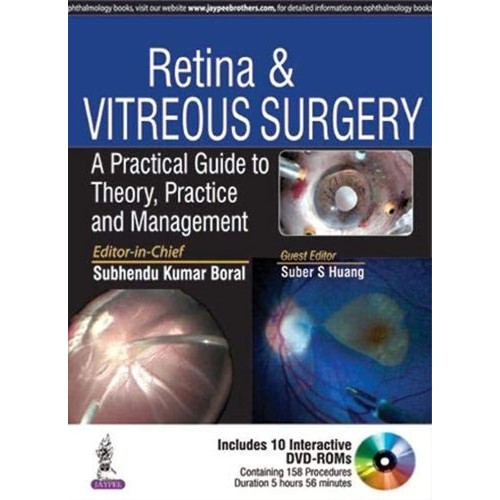 RETINA & VITREOUS SURGERY A PRACTICAL GUIDE T...