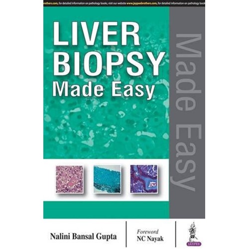 LIVER BIOPSY MADE EASY