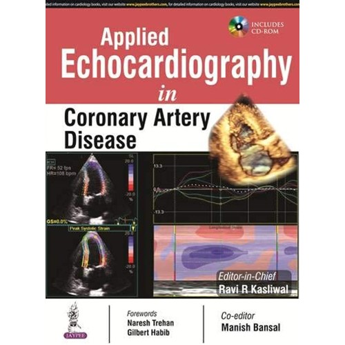 APPLIED ECHOCARDIOGRAPHY IN CORONARY ARTERY D...