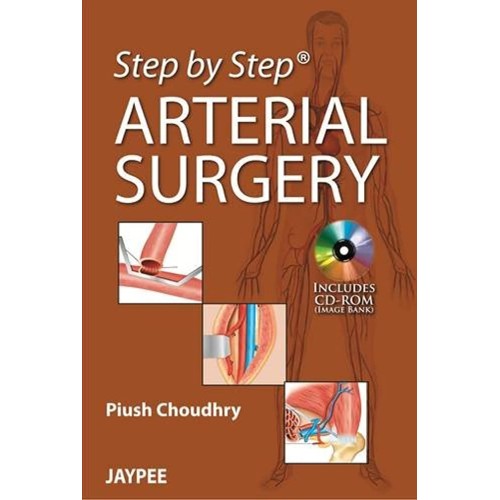 STEP BY STEP ARTERIAL SURGERY WITH CD-ROM