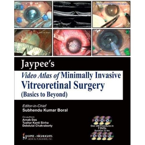 JAYPEE VIDEO ATLAS OF MINIMALLY INVASIVE VITR...