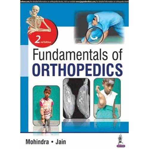 FUNDAMENTALS OF ORTHOPEDICS