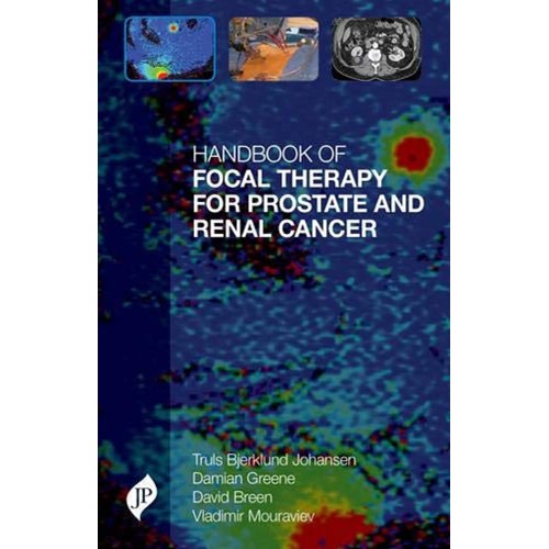 HANDBOOK OF FOCAL THERAPY FOR PROSTATE AND RENAL CANCER