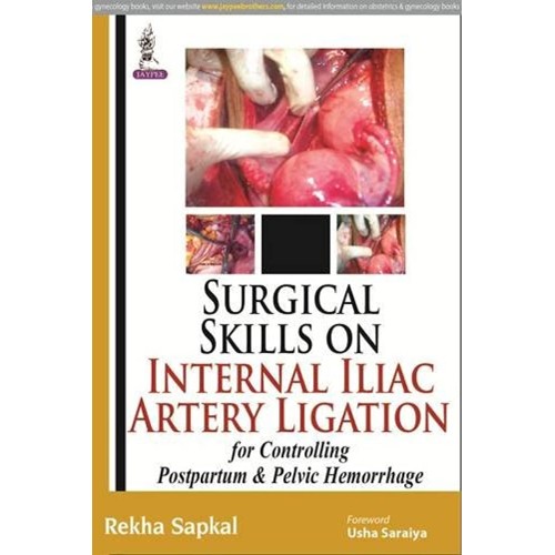 SURGICAL SKILLS ON INTERNAL ILIAC ARTERY LIGA...