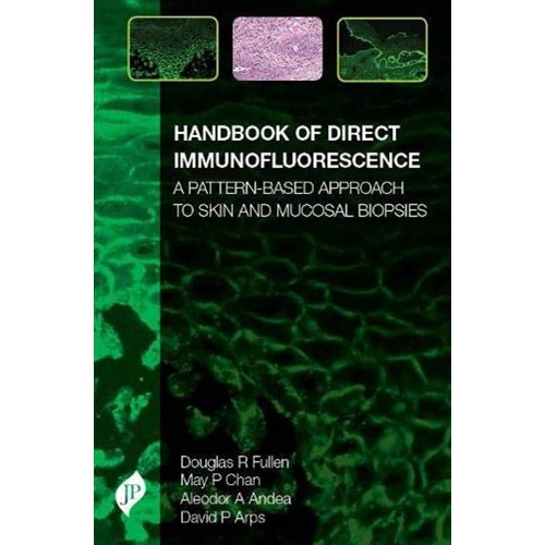 HANDBOOK OF DIRECT IMMUNOFLUORESCENCE: A PATTERN -BASED APPROACH TO SKIN AND MUCOSAL BIOPSIES