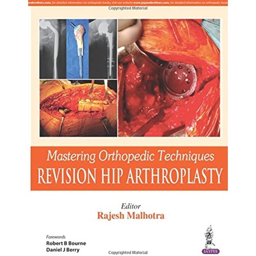 MASTERING ORTHOPEDIC TECHNIQUES REVISION HIP ARTHROPLASTY