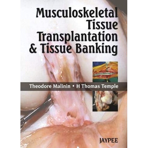 MUSCULOSKELETAL TISSUE TRANSPLANTATION & TISSUE BANKING