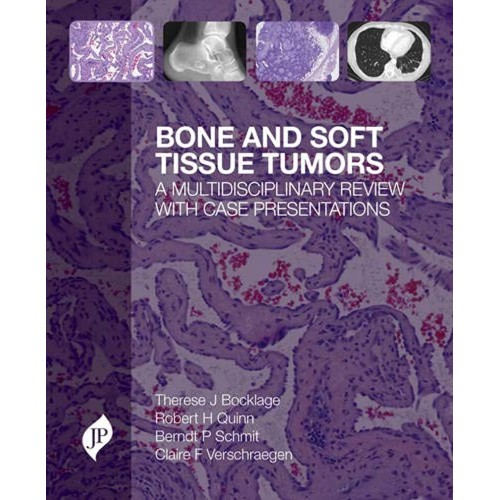 BONE AND SOFT TISSUE TUMORS:A MULTIDISCIPLINARY REVIEW WITH CASE PRESENTATIONS