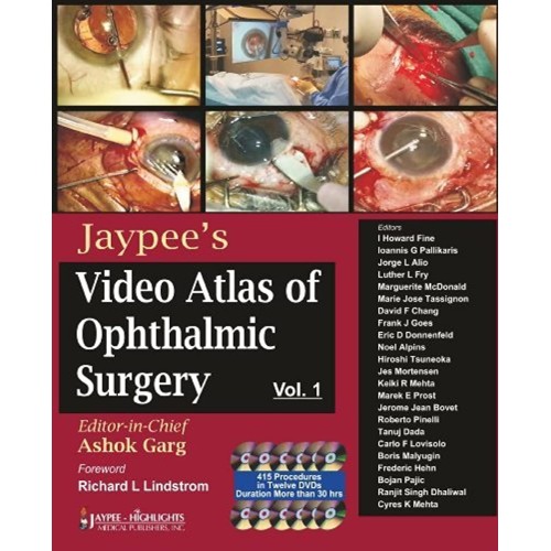 JAYPEE'S VIDEO ATLAS OF OPHTHALMIC SURGERY VO...