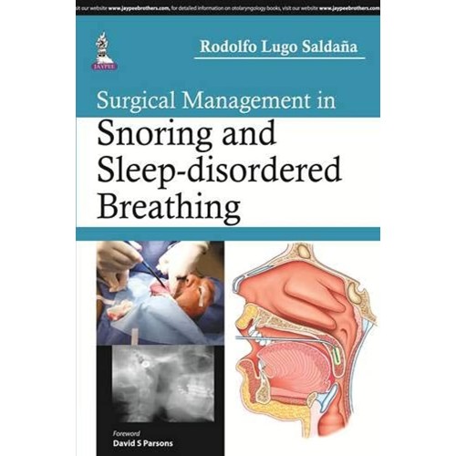 SURGICAL MANAGEMENT IN SNORING AND SLEEP-DISO...