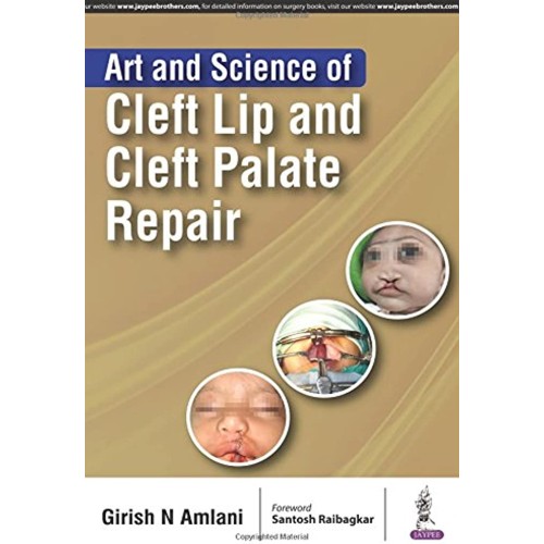 ART AND SCIENCE OF CLEFT LIP AND CLEFT PALATE...