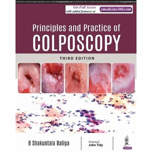 PRINCIPLES AND PRACTICE OF COLPOSCOPY