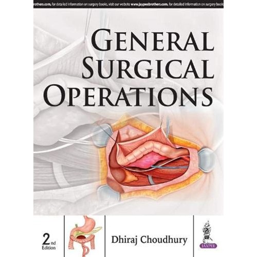 GENERAL SURGICAL OPERATIONS