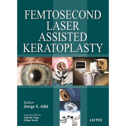 FEMTOSECOND LASER ASSISTED KERATOPLASTY